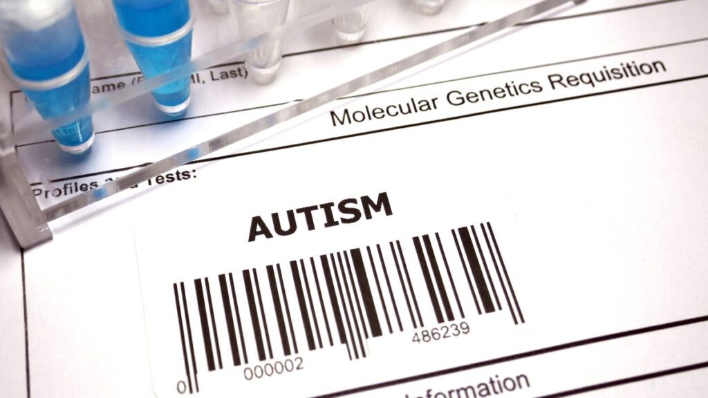Lab supplies picturing an attempted cure for autism